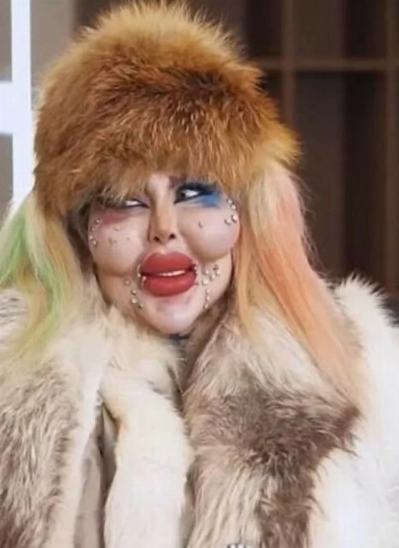 388 عملية تجميل في جسد واحد.. مؤثرة إيرانية تثير صدمة وجدلاً عالمياً downloadfile3 1