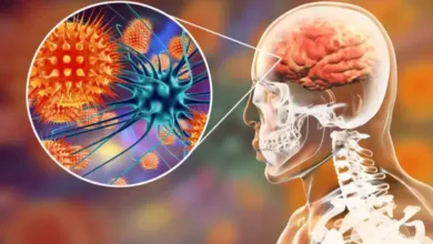 فيروس نيباه