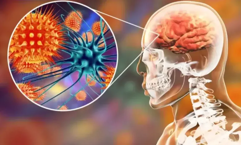 فيروس نيباه