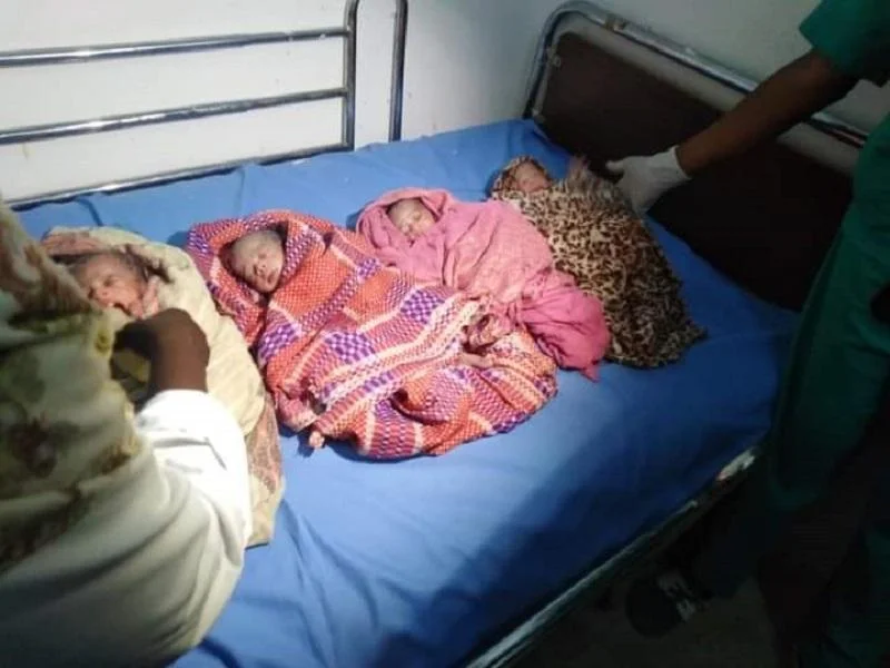 حالة نادرة... سيدة في كردفان تضع 4 توائم بصحة جيدة توائم