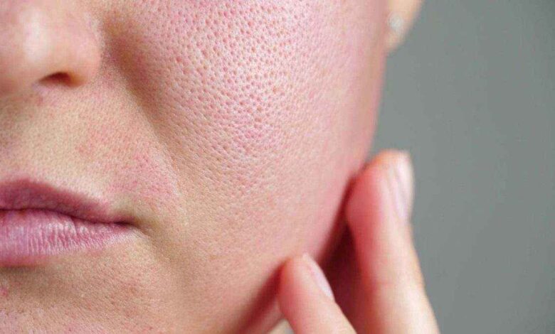 دليل شامل لاستخدام مضادات الأكسدة في روتين العناية بالبشرة صورة توضيحية للعناية بالبشرة
