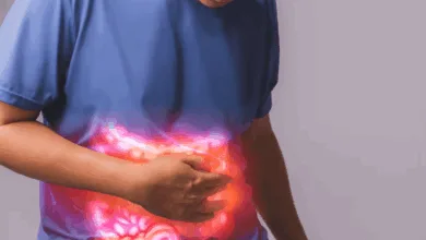 القولون العصبي