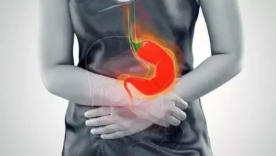 تعاني من الحموضة؟ هذه الأطعمة قد تساعدك على التخلص منها حموضة المعدة