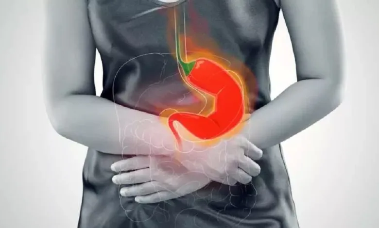 تعاني من الحموضة؟ هذه الأطعمة قد تساعدك على التخلص منها حموضة المعدة